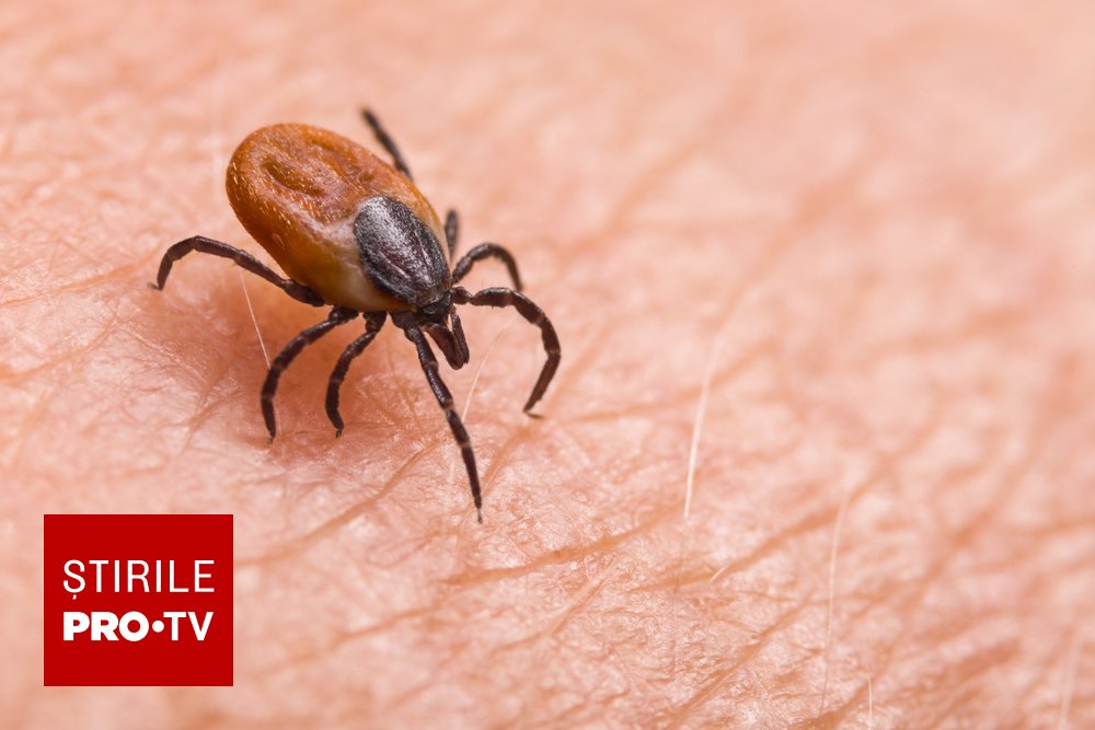 Sindromul alfa-gal: alergie la carne provocată de mușcătura de căpușă, în creștere în SUA