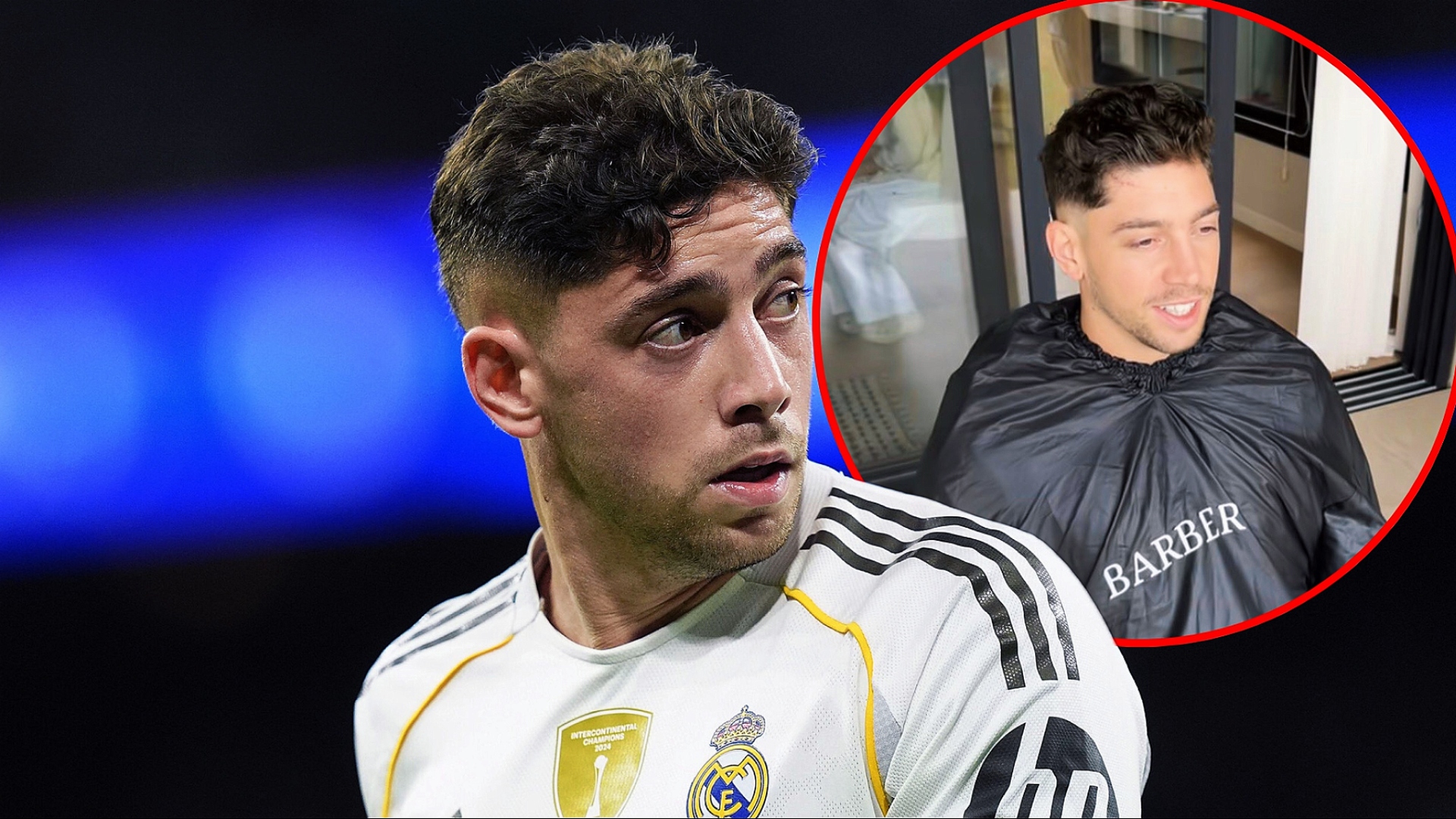 Valverde, cicatrice uriașă pe frunte după bătaia cu Tchouameni la Real Madrid