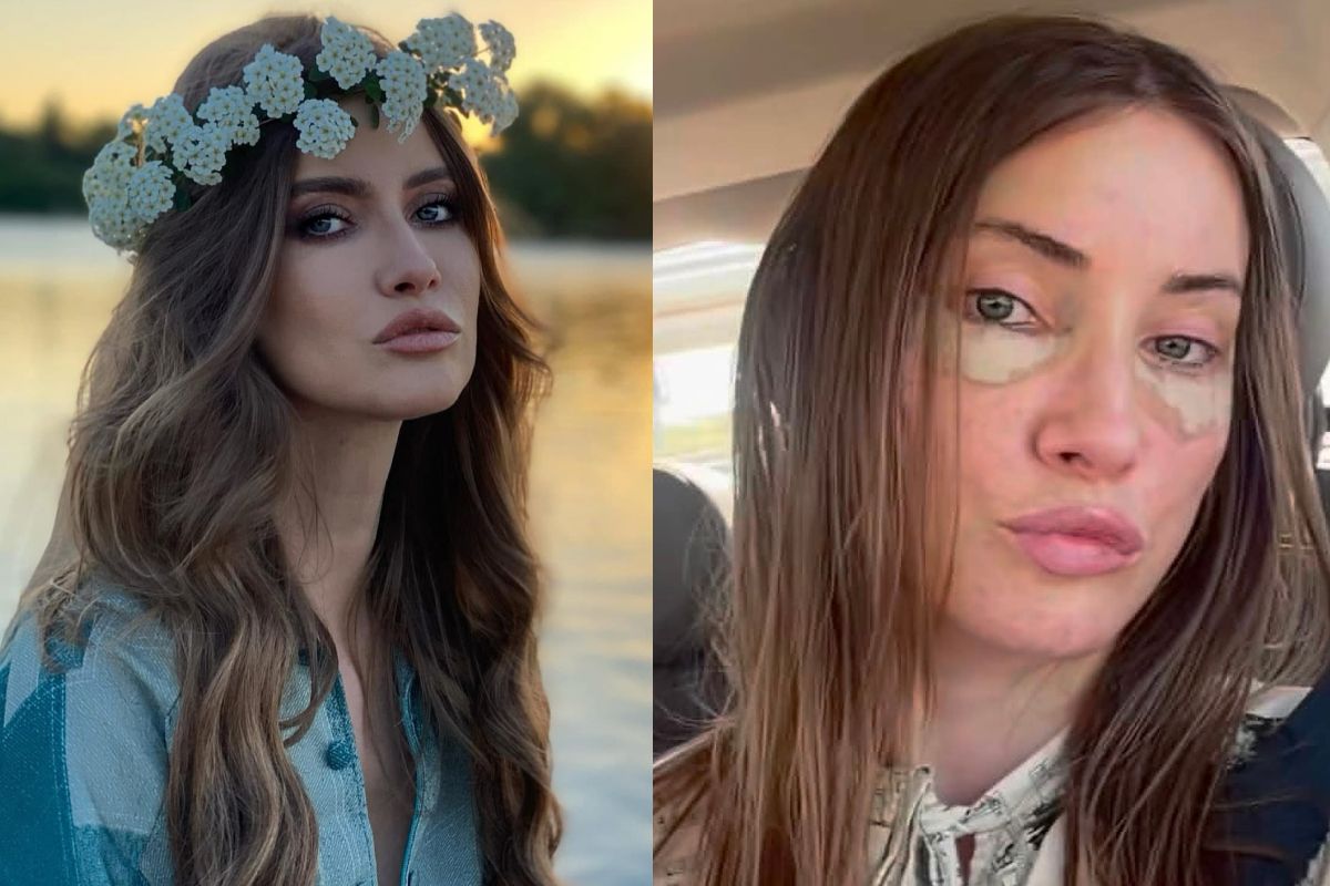 Iulia Albu, lifting facial deep plane la 44 de ani: „Nu îmi doresc să arăt altfel”